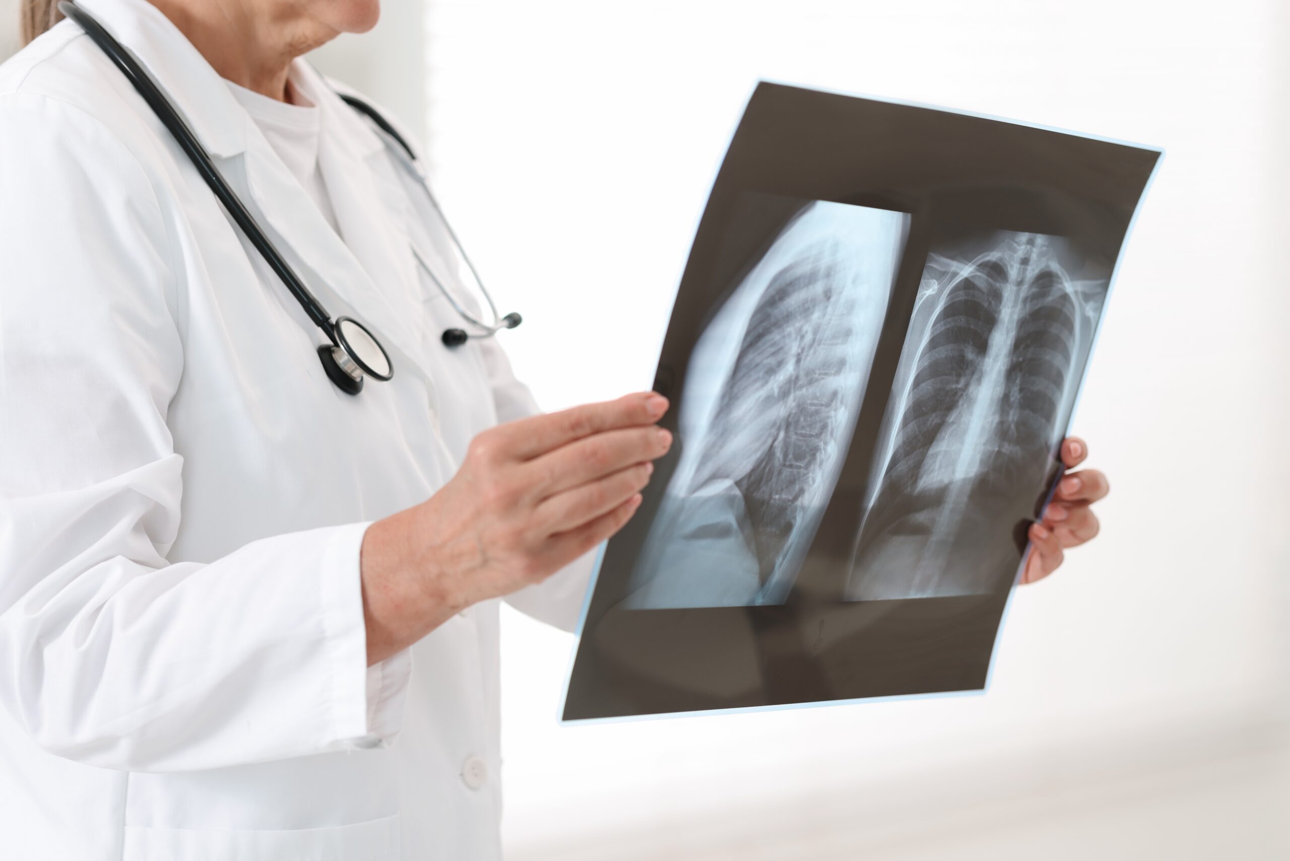Lung,Disease.,Doctor,Examining,Chest,X-ray,In,Clinic,,Closeup